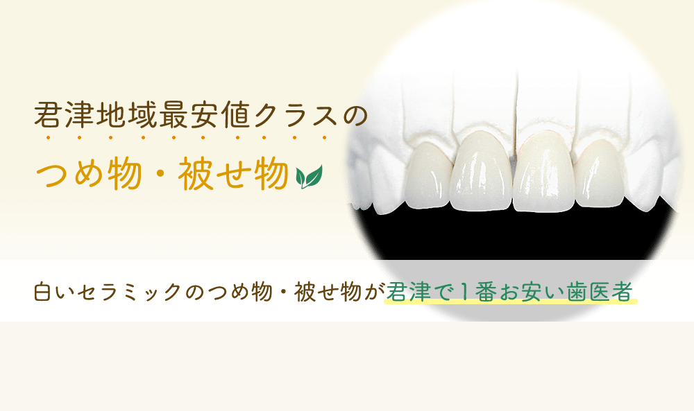 君津地域最安値クラスのつめ物・被せ物