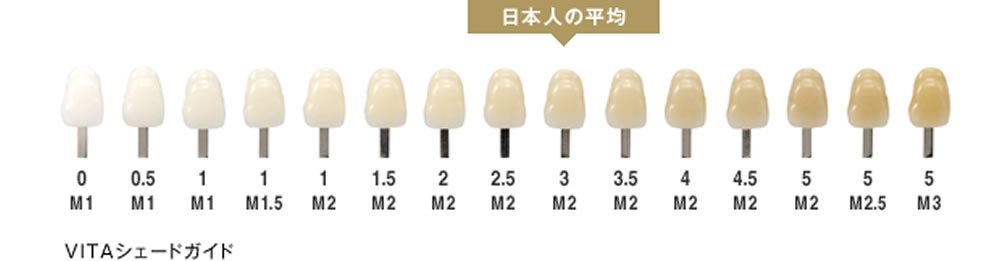 どの程度キレイになりますか?